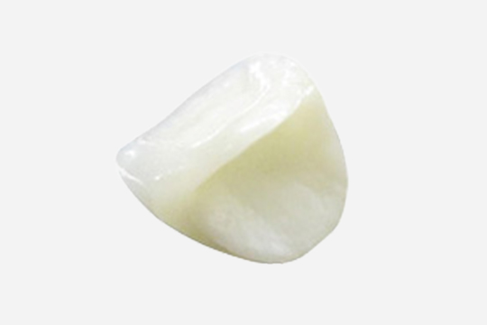 メタルフリーのセラミック歯 イメージ画像